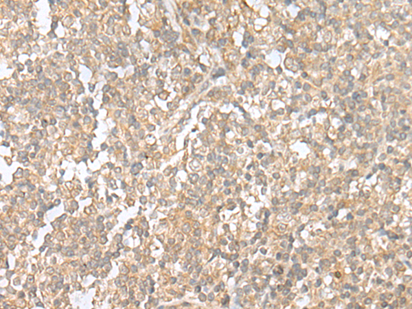 Rabbit Polyclonal Antibody to NOS1