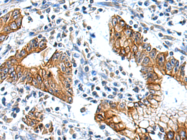 Rabbit Polyclonal Antibody to NTN1