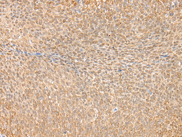 Rabbit Polyclonal Antibody to BIRC7
