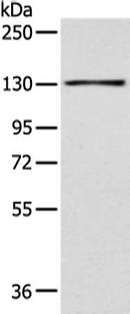 Rabbit Polyclonal Antibody to SMARCA1