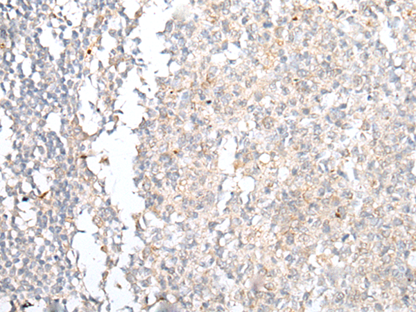 Rabbit Polyclonal Antibody to CCR4