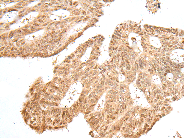Rabbit Polyclonal Antibody to JUNB
