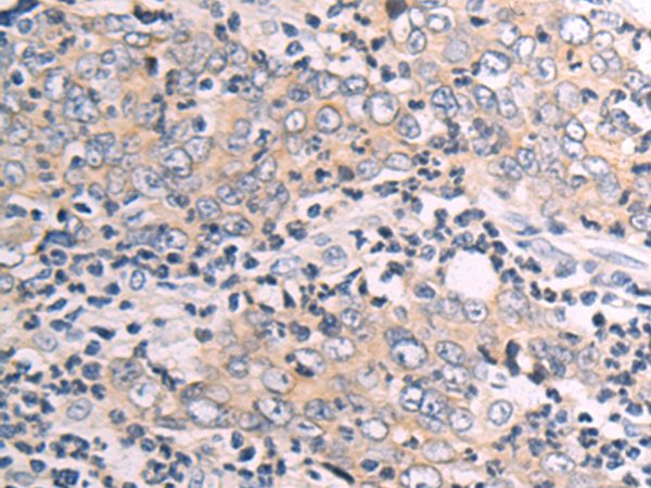 Rabbit Polyclonal Antibody to CX3CR1