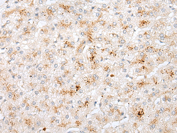 Rabbit Polyclonal Antibody to STK26