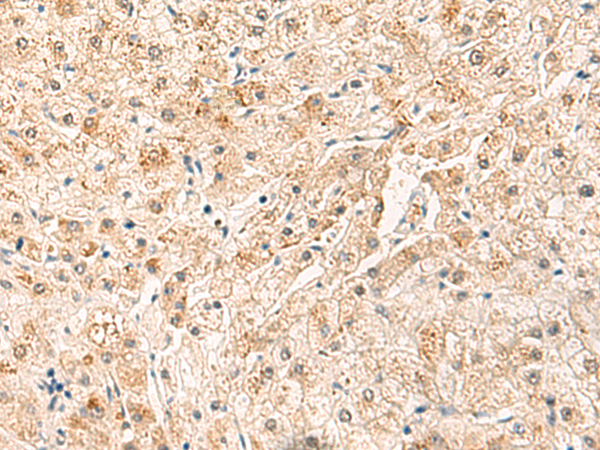 Rabbit Polyclonal Antibody to SYT16