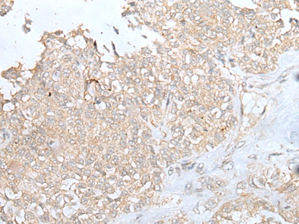 Rabbit Polyclonal Antibody to DOK6