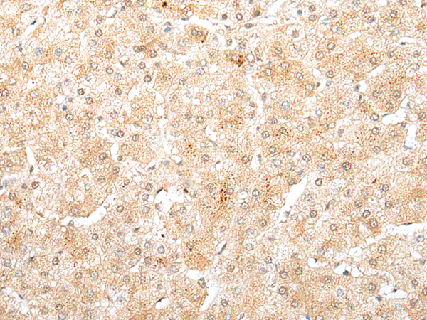 Rabbit Polyclonal Antibody to DOK7