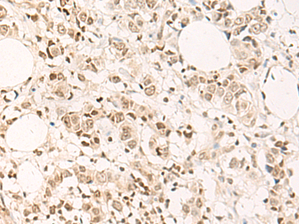 Rabbit Polyclonal Antibody to DPPA4
