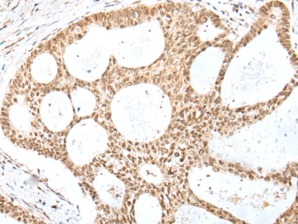 Rabbit Polyclonal Antibody to E2F8