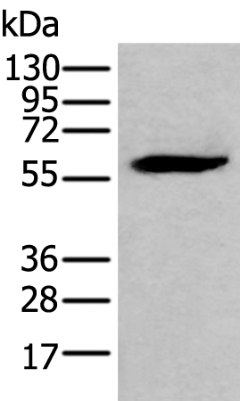 Rabbit Polyclonal Antibody to EGR2