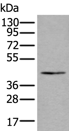 Rabbit Polyclonal Antibody to ELK1