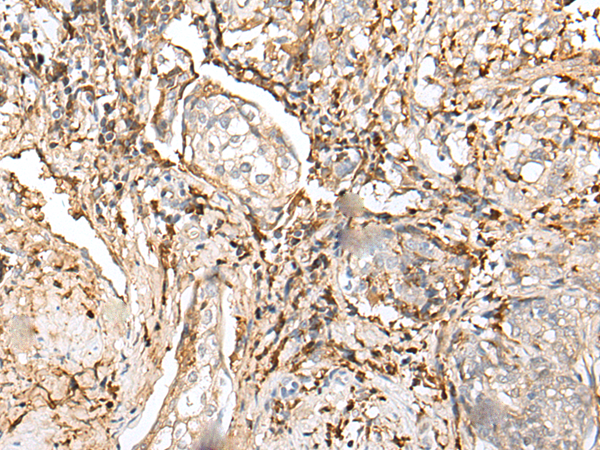 Rabbit Polyclonal Antibody to EFNA4