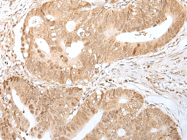 Rabbit Polyclonal Antibody to DUSP16