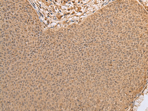 Rabbit Polyclonal Antibody to FOXO4