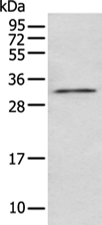 Rabbit Polyclonal Antibody to NUDT5