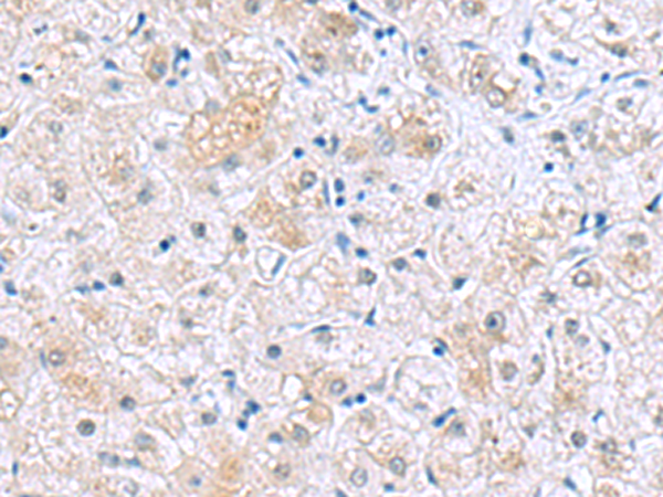 Rabbit Polyclonal Antibody to NUDT8