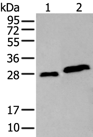 Rabbit Polyclonal Antibody to AK4