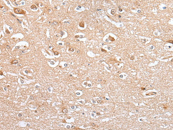Rabbit Polyclonal Antibody to CES4A