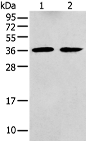 Rabbit Polyclonal Antibody to GNAI2