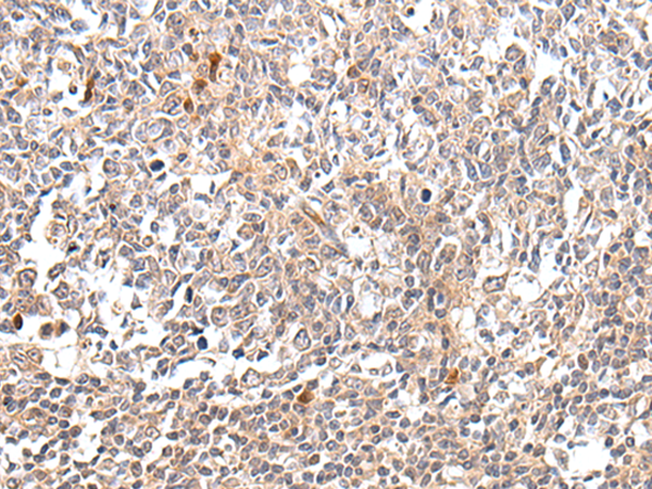 Rabbit Polyclonal Antibody to DDIT3