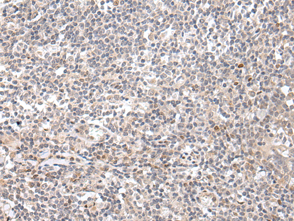 Rabbit Polyclonal Antibody to GNLY