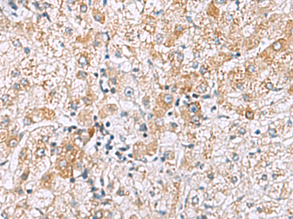 Rabbit Polyclonal Antibody to GPC3