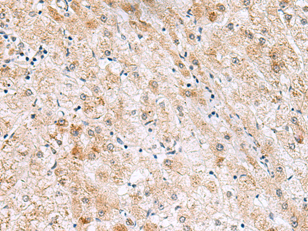 Rabbit Polyclonal Antibody to GPC2