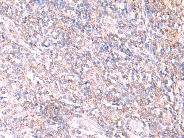 Rabbit Polyclonal Antibody to TNFSF18