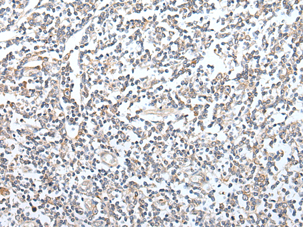 Rabbit Polyclonal Antibody to GZMM
