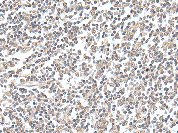 Rabbit Polyclonal Antibody to GRM4
