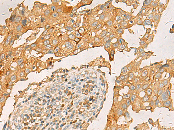 Rabbit Polyclonal Antibody to CXCL1