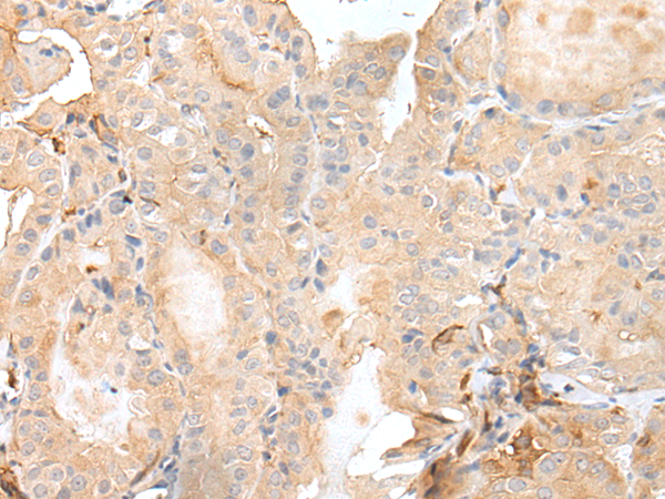 Rabbit Polyclonal Antibody to GSK3B