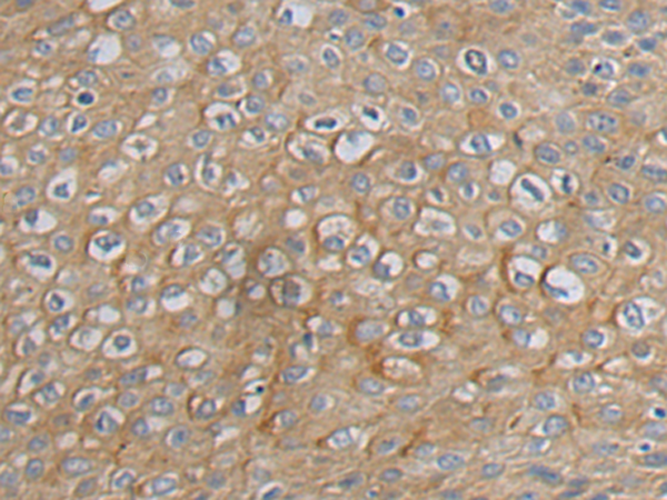 Rabbit Polyclonal Antibody to GTSE1