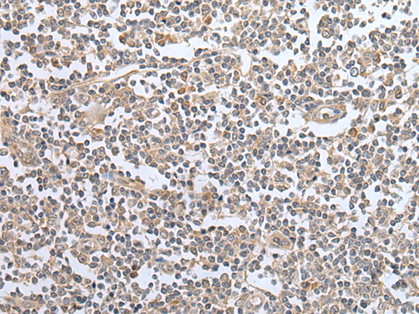 Rabbit Polyclonal Antibody to SPAM1