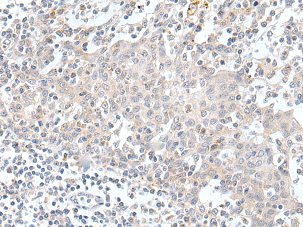 Rabbit Polyclonal Antibody to KCNH1