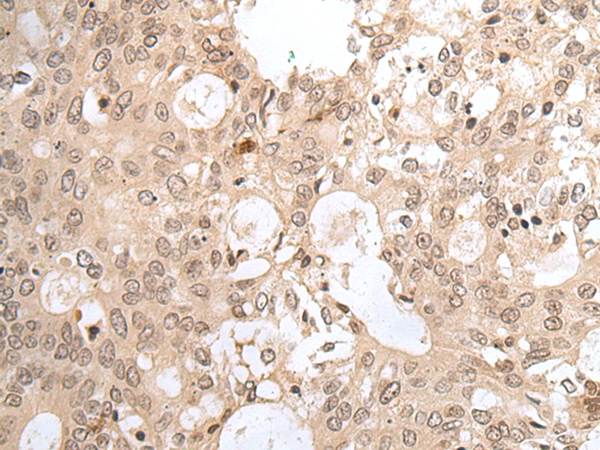 Rabbit Polyclonal Antibody to HCN3