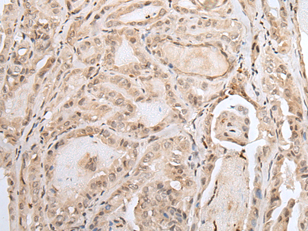 Rabbit Polyclonal Antibody to H2BC11