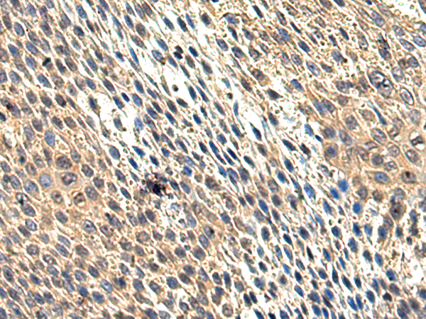 Rabbit Polyclonal Antibody to HDAC4