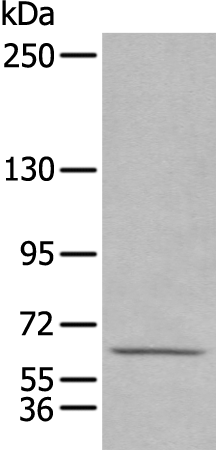 Rabbit Polyclonal Antibody to HPSE2