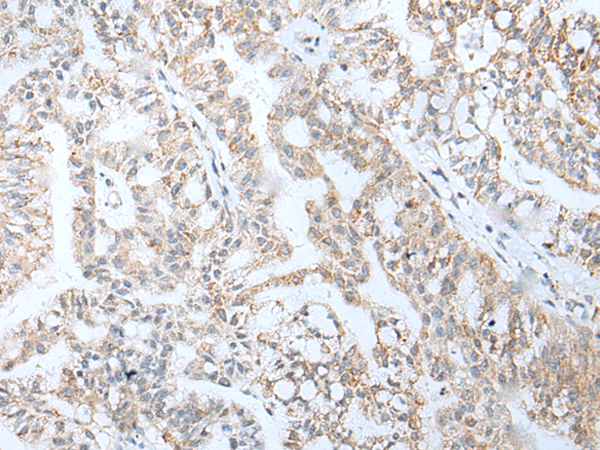 Rabbit Polyclonal Antibody to HOXA5