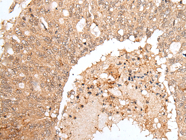 Rabbit Polyclonal Antibody to HOXB9