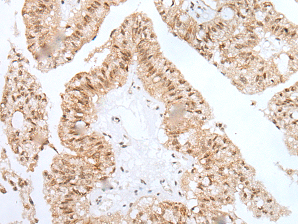 Rabbit Polyclonal Antibody to HOXB5