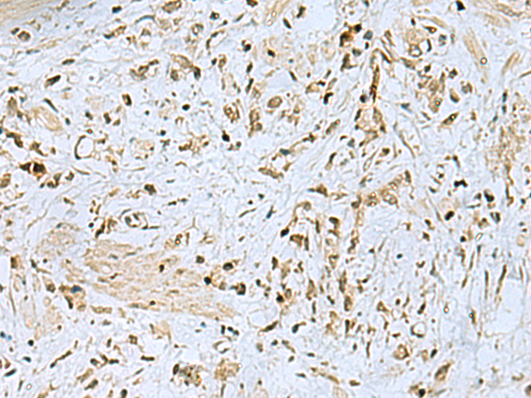 Rabbit Polyclonal Antibody to HOXC9