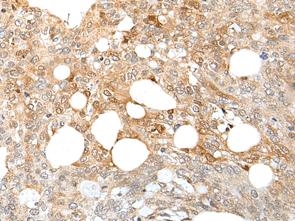 Rabbit Polyclonal Antibody to HOXD10