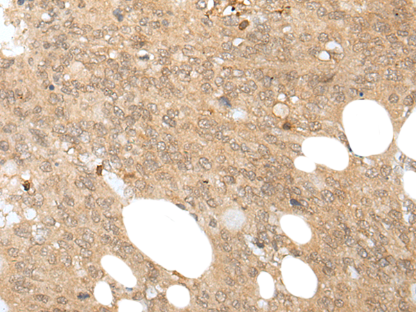 Rabbit Polyclonal Antibody to HOXD12