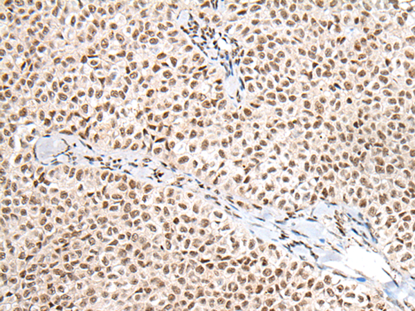 Rabbit Polyclonal Antibody to NRG1