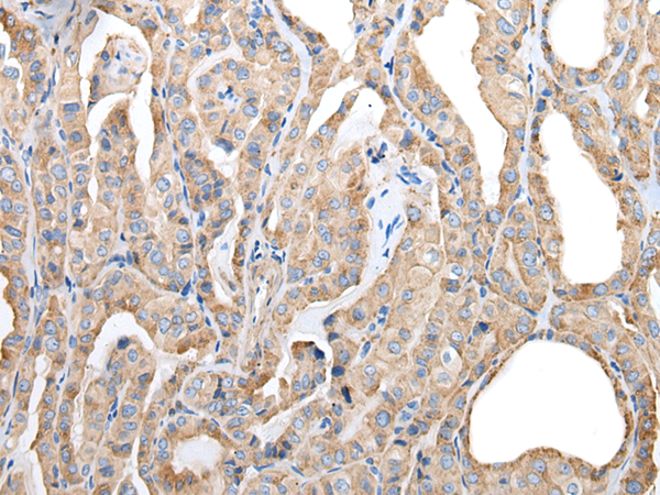 Rabbit Polyclonal Antibody to PLAAT3