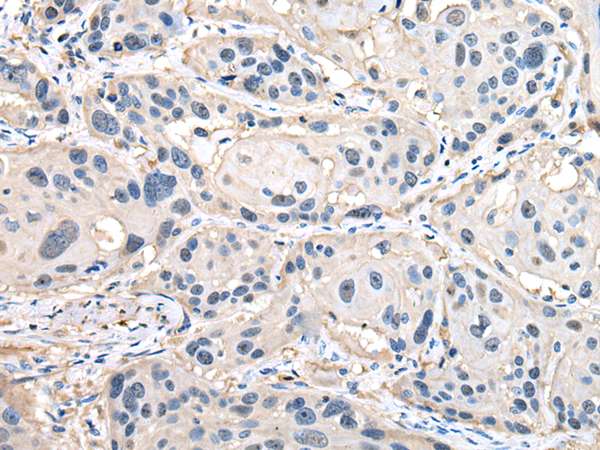 Rabbit Polyclonal Antibody to HSP90AB1