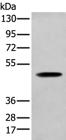 Rabbit Polyclonal Antibody to SERPINH1