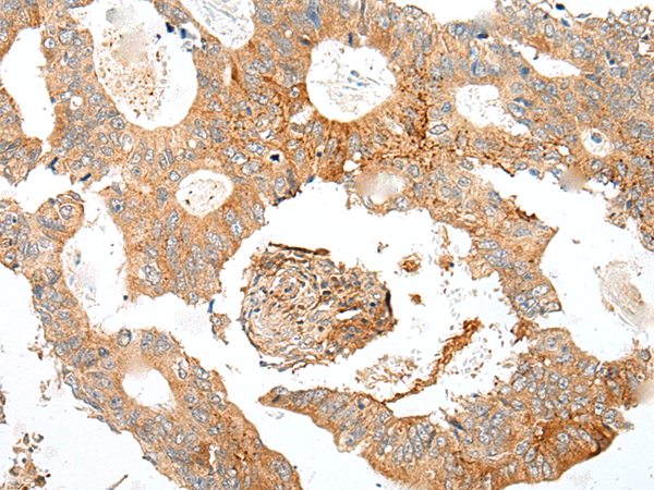 Rabbit Polyclonal Antibody to SDC2